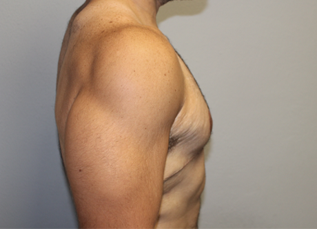 post gyno (1).JPG