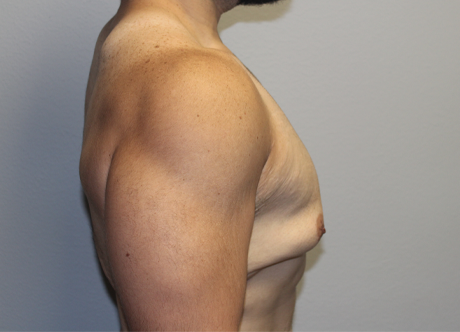 pregyno (1).JPG