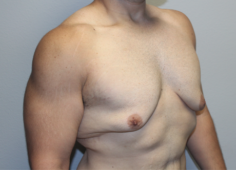 pregyno (3).JPG