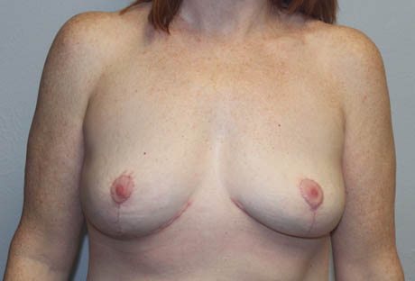 rai_0001_case1a (2).JPG