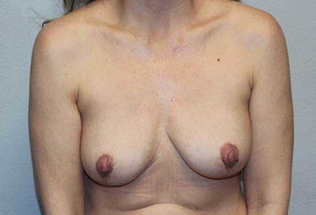 rai_0007_case2a (2).JPG