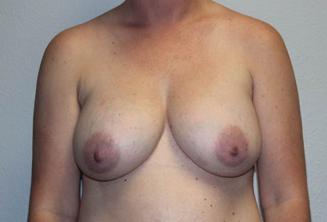 rai_0012_case3b (2).JPG